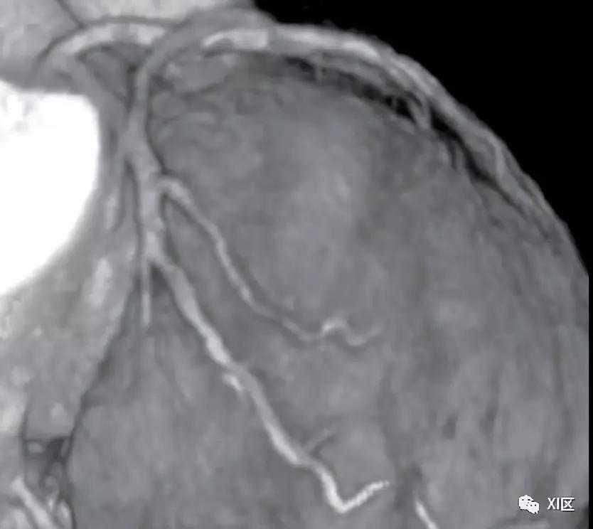 1968—2018 回溯CT发展的半个世纪
