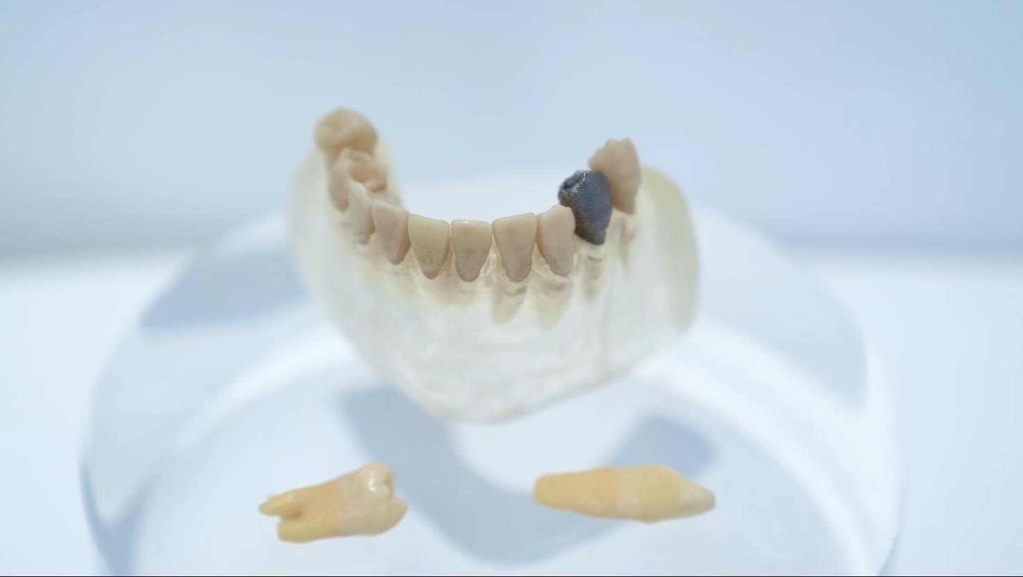 “湾”转“黑科技”｜3D打印你的牙